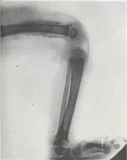 Рентгеновская картина при цинге