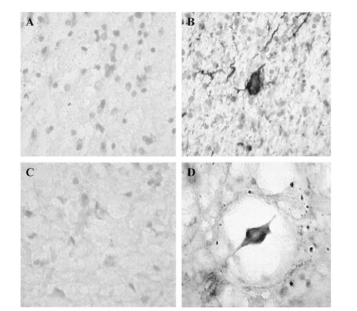 Иммуноокрашивание гиперфосфорилированного тау-белка в вентральном роге поясничного отдела спинного мозга